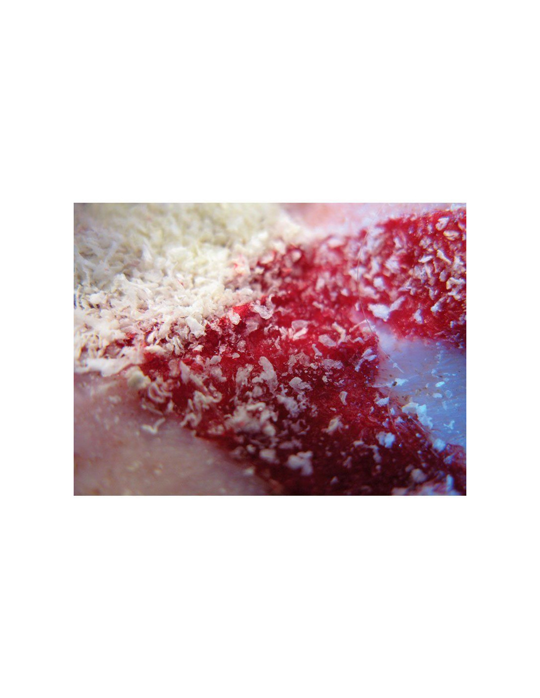 CELOX A | Aplicador De Gránulos Hemostáticos